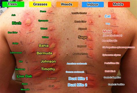 alex bekker|Medications Currently Taking Allergies Major Symptoms。